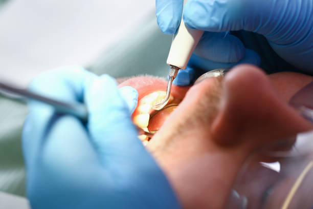 Best Emergency Treatment for Jaw Pain or Injury in Wolcott, IN